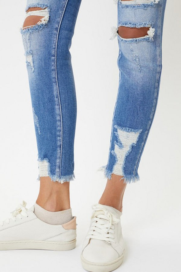 Lys Distressed Skinny Jeans